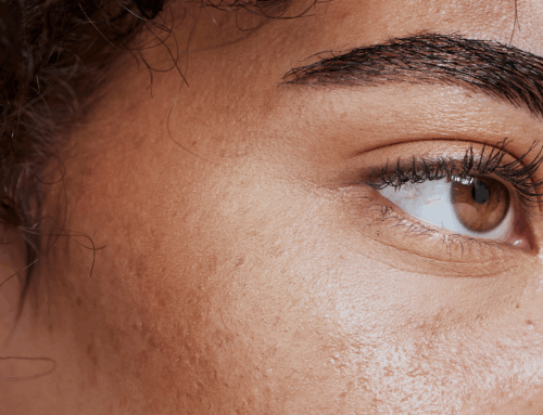 Salmon Sperm Skincare Is Trending—But Does It Actually Do Anything for Skin? I Asked a Dermatologist